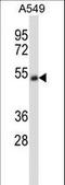 Cholinergic Receptor Nicotinic Alpha 5 Subunit antibody, LS-C168755, Lifespan Biosciences, Western Blot image 