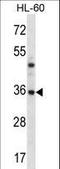 Proteasome Subunit Beta 8 antibody, LS-C162235, Lifespan Biosciences, Western Blot image 