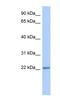 Trafficking Protein Particle Complex 5 antibody, NBP1-56296, Novus Biologicals, Western Blot image 