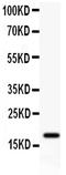 FXYD Domain Containing Ion Transport Regulator 5 antibody, GTX12101, GeneTex, Western Blot image 