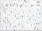 Hexose-6-Phosphate Dehydrogenase/Glucose 1-Dehydrogenase antibody, LS-C115273, Lifespan Biosciences, Immunohistochemistry frozen image 