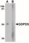 Glycerophosphodiester Phosphodiesterase Domain Containing 5 antibody, NBP2-41268, Novus Biologicals, Western Blot image 