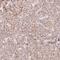 Solute Carrier Family 17 Member 4 antibody, NBP2-57090, Novus Biologicals, Immunohistochemistry frozen image 