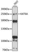 Lysine Acetyltransferase 6A antibody, 15-827, ProSci, Western Blot image 