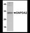 Glucosamine-6-Phosphate Deaminase 2 antibody, NBP1-72110, Novus Biologicals, Western Blot image 