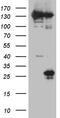 CD160 Molecule antibody, M06168, Boster Biological Technology, Western Blot image 