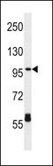 Carnitine Palmitoyltransferase 1C antibody, LS-C167011, Lifespan Biosciences, Western Blot image 