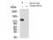 BTB Domain And CNC Homolog 2 antibody, A04096, Boster Biological Technology, Western Blot image 