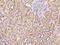 Protein Kinase D3 antibody, 200783-T08, Sino Biological, Immunohistochemistry paraffin image 