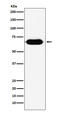 Ring Finger Protein 8 antibody, M00707, Boster Biological Technology, Western Blot image 