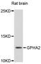 Glycoprotein Hormone Subunit Alpha 2 antibody, STJ112613, St John