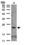 CKLF Like MARVEL Transmembrane Domain Containing 3 antibody, PA5-28848, Invitrogen Antibodies, Western Blot image 