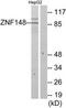 Zinc finger protein 148 antibody, TA314693, Origene, Western Blot image 