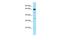 NADPH Oxidase 5 antibody, PA5-43433, Invitrogen Antibodies, Western Blot image 