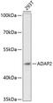 ArfGAP With Dual PH Domains 2 antibody, 15-176, ProSci, Western Blot image 