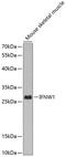 Interferon Omega 1 antibody, A10413-2, Boster Biological Technology, Western Blot image 