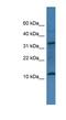 Chromosome 14 Open Reading Frame 177 antibody, NBP1-79606, Novus Biologicals, Western Blot image 