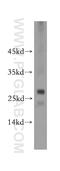Bridging Integrator 3 antibody, 20186-1-AP, Proteintech Group, Western Blot image 