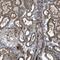 Transmembrane Protein 132C antibody, PA5-53350, Invitrogen Antibodies, Immunohistochemistry paraffin image 