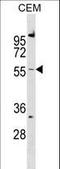 Calcitonin Receptor Like Receptor antibody, LS-C159260, Lifespan Biosciences, Western Blot image 