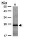 RAB2B, Member RAS Oncogene Family antibody, PA5-21962, Invitrogen Antibodies, Western Blot image 