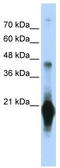 Chromosome 17 Open Reading Frame 49 antibody, TA337767, Origene, Western Blot image 
