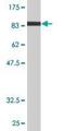 Nuclear Receptor Subfamily 1 Group D Member 1 antibody, H00009572-M01, Novus Biologicals, Western Blot image 