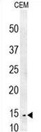 Cysteine Rich C-Terminal 1 antibody, AP51070PU-N, Origene, Western Blot image 