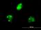 KH RNA Binding Domain Containing, Signal Transduction Associated 1 antibody, H00010657-M03, Novus Biologicals, Immunocytochemistry image 