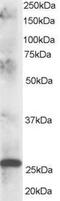 Caseinolytic Mitochondrial Matrix Peptidase Proteolytic Subunit antibody, PA5-18138, Invitrogen Antibodies, Western Blot image 