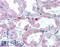Growth Hormone Receptor antibody, LS-B2149, Lifespan Biosciences, Immunohistochemistry paraffin image 