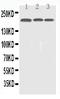 EGFR antibody, PB9016, Boster Biological Technology, Western Blot image 