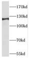 Transforming Acidic Coiled-Coil Containing Protein 1 antibody, FNab08467, FineTest, Western Blot image 