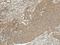 Cyclin D1 antibody, LS-C776408, Lifespan Biosciences, Immunohistochemistry frozen image 