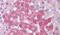 Lysyl Oxidase Like 2 antibody, PA5-32900, Invitrogen Antibodies, Immunohistochemistry paraffin image 