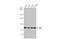 Nicotinamide Nucleotide Transhydrogenase antibody, GTX103015, GeneTex, Western Blot image 