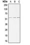 Activin A Receptor Like Type 1 antibody, orb213522, Biorbyt, Western Blot image 