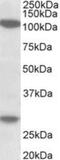 Ubinuclein-1 antibody, NBP2-26142, Novus Biologicals, Western Blot image 