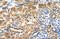 Glucosaminyl (N-Acetyl) Transferase 3, Mucin Type antibody, 29-880, ProSci, Immunohistochemistry paraffin image 