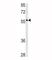 X-Linked Inhibitor Of Apoptosis antibody, F49444-0.4ML, NSJ Bioreagents, Western Blot image 