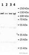 Transient Receptor Potential Cation Channel Subfamily V Member 4 antibody, ab39260, Abcam, Western Blot image 