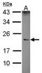 Immunoglobulin Lambda Like Polypeptide 1 antibody, NBP2-16934, Novus Biologicals, Western Blot image 