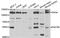 Prolyl 4-Hydroxylase, Transmembrane antibody, PA5-76853, Invitrogen Antibodies, Western Blot image 