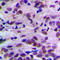 Cyclin Dependent Kinase 2 antibody, LS-C351987, Lifespan Biosciences, Immunohistochemistry frozen image 
