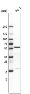 Inositol Hexakisphosphate Kinase 1 antibody, HPA040825, Atlas Antibodies, Western Blot image 