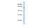 Carboxylesterase 5A antibody, GTX45872, GeneTex, Western Blot image 