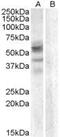 Arylsulfatase D antibody, PA5-18918, Invitrogen Antibodies, Western Blot image 