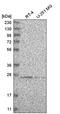 HscB Mitochondrial Iron-Sulfur Cluster Cochaperone antibody, HPA031518, Atlas Antibodies, Western Blot image 