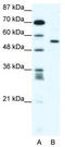 RUNX Family Transcription Factor 2 antibody, TA341699, Origene, Western Blot image 