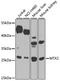 Metaxin 2 antibody, STJ110265, St John